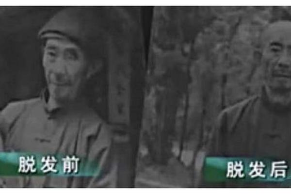 男人没头发是什么命?解读光头背后的秘密与生活智慧 男人没头发是什么命?解读光头背后的秘密与生活智慧