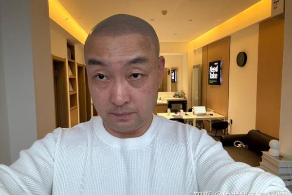 中年秃头的命格与人生哲学探讨:智慧与魅力的别样体现 中年秃头的命格与人生哲学探讨:智慧与魅力的别样体现