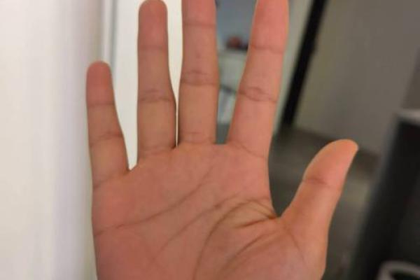 人手指细长的命运解读:揭示个性与未来的奥秘 人手指细长的命运解读:揭示个性与未来的奥秘