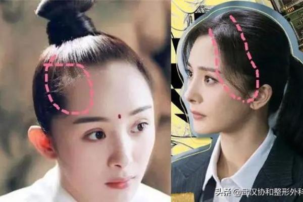 女人发际线高,命运如何解读? 女人发际线高,命运如何解读?