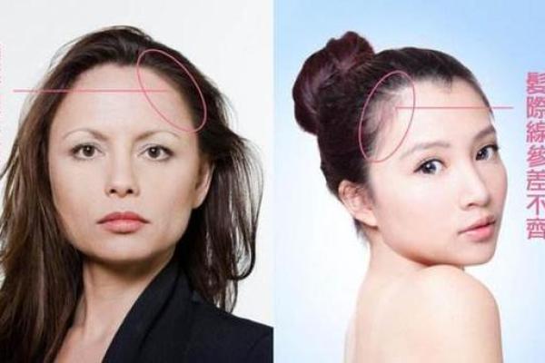 女人发际线高,命运如何解读? 女人发际线高,命运如何解读?