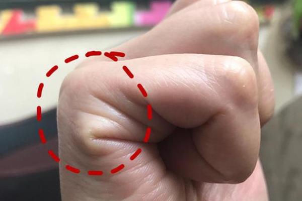 掌纹解读:谁是命中注定的状元? 掌纹解读:谁是命中注定的状元?