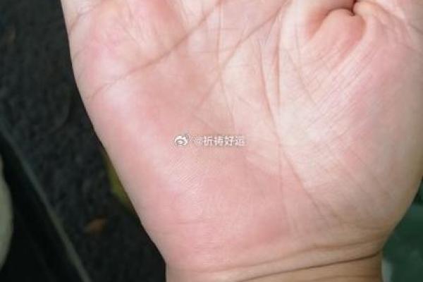 探索手掌颜色与命运的秘密:你手中的人生密码! 探索手掌颜色与命运的秘密:你手中的人生密码!