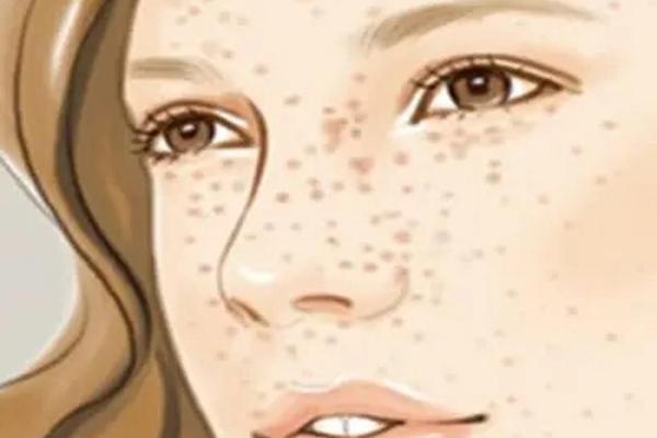 脚上有痣的命理分析：小小痣斑的大秘密！