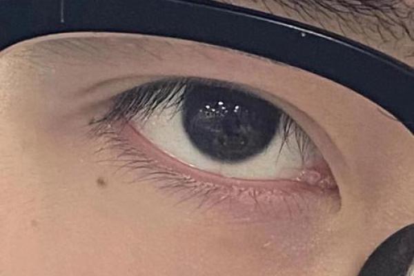 男人泪痣的命运解析:揭示其背后的深层含义与影响 男人泪痣的命运解析:揭示其背后的深层含义与影响