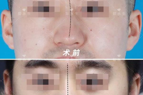 男人鼻子向左歪的命运解析与性格剖析