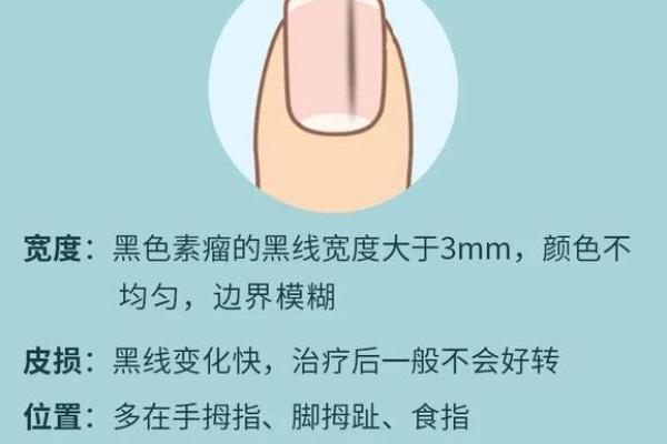 指甲短的命运解析:揭示手指背后的秘密与人生轨迹 指甲短的命运解析:揭示手指背后的秘密与人生轨迹