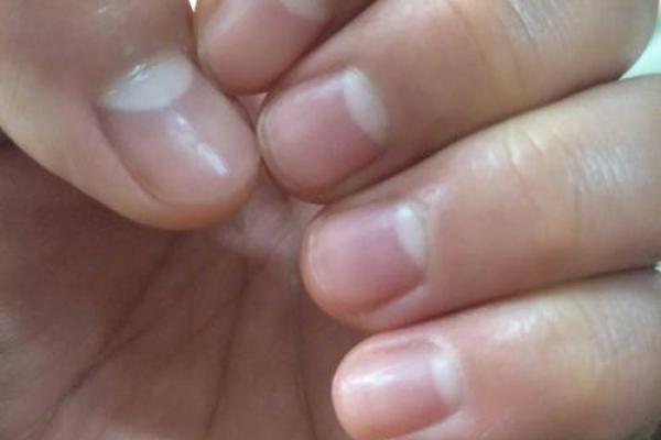 指甲短的命运解析:揭示手指背后的秘密与人生轨迹 指甲短的命运解析:揭示手指背后的秘密与人生轨迹