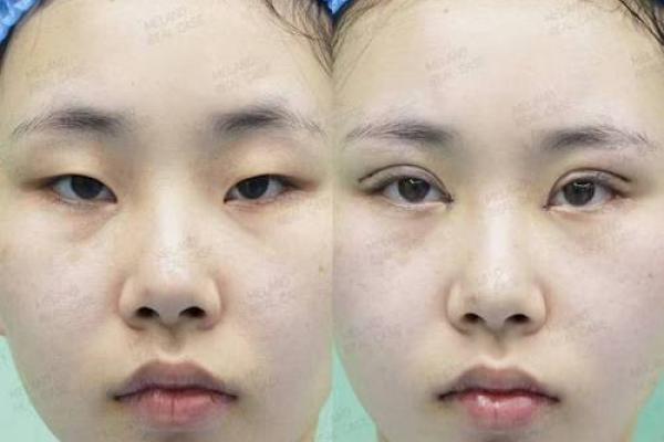 吊眼梢的女人：美丽与命运交织的故事