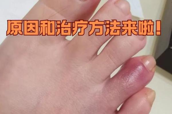 女人脚趾有节，命运的秘密与生活的启示
