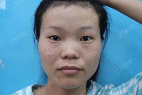 女生鼻子塌是什么命？深度解析与命理启示