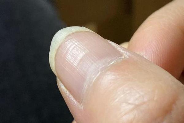 男生指甲薄的秘密：揭示命运与性格的微妙联系