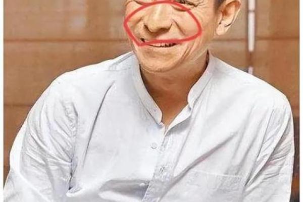 颧骨突出的男人：独特相貌与命运分析