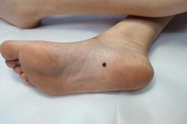 脚旁边突起的秘密:它暗示着你的命运走向 脚旁边突起的秘密:它暗示着你的命运走向