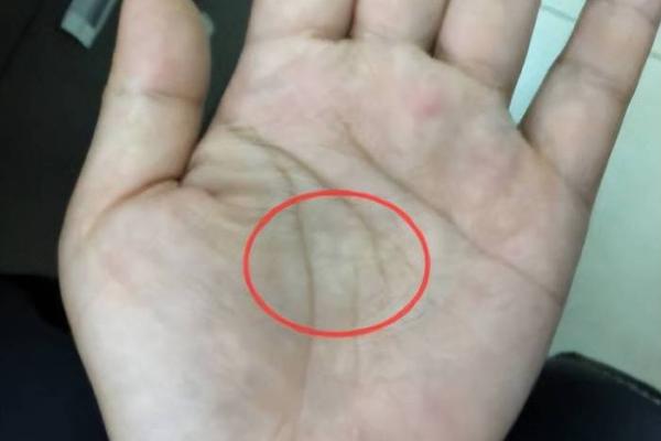 双手断掌的女人:命运的转折与人生的启示 双手断掌的女人:命运的转折与人生的启示