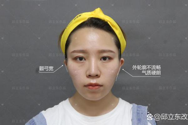 揭秘下颌凹陷:影响命运的隐秘特征与历史渊源 揭秘下颌凹陷:影响命运的隐秘特征与历史渊源