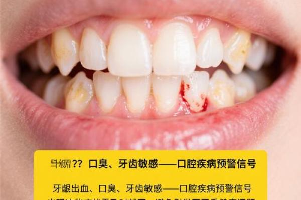 揭开牙齿之谜:为何牙齿与富贵命息息相关? 揭开牙齿之谜:为何牙齿与富贵命息息相关?