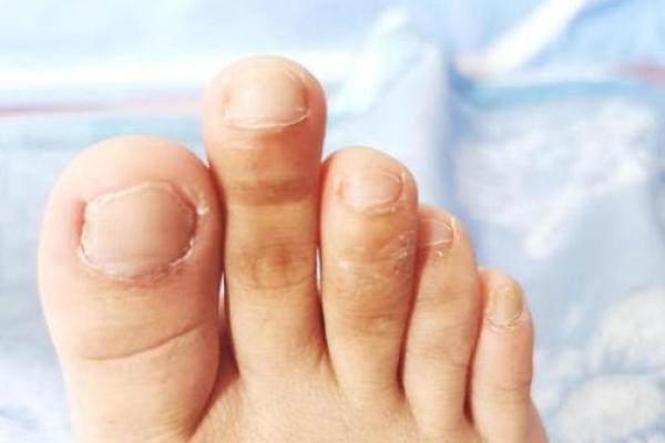 你的命运从脚趾看，长短与性格的秘密！