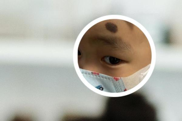 手腕上的胎记：命运与运势的神秘解读