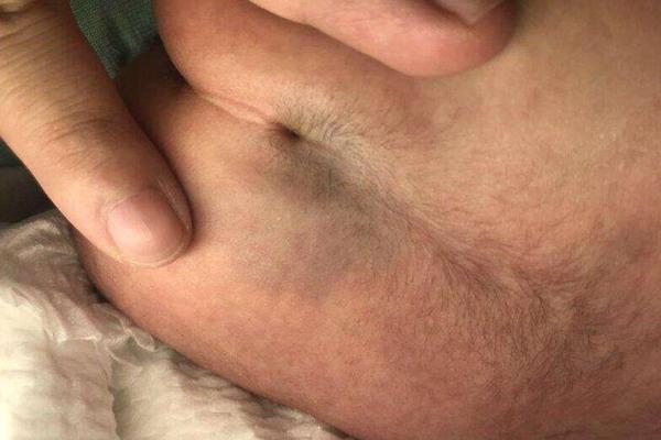 脊椎中间长痣的神秘寓意：它揭示了你的性格与命运！