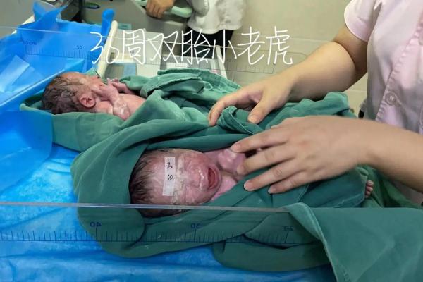 命运的转折：那些夺走宝宝生命的无形因素