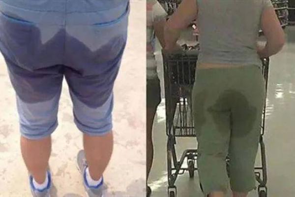 揭秘“屁股沟长毛”的命运暗示，影响生活的独特信号！