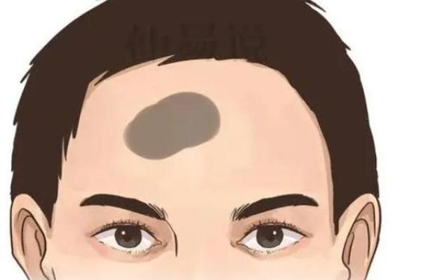 腰上的胎记暗示你的命运与性格特征! 腰上的胎记暗示你的命运与性格特征!