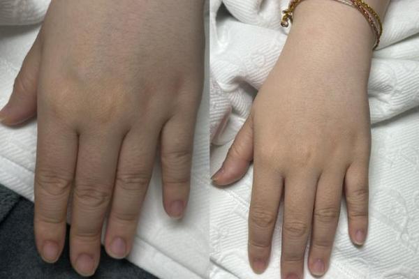 探秘手部粗糙的秘密：命运与生活的微妙关联