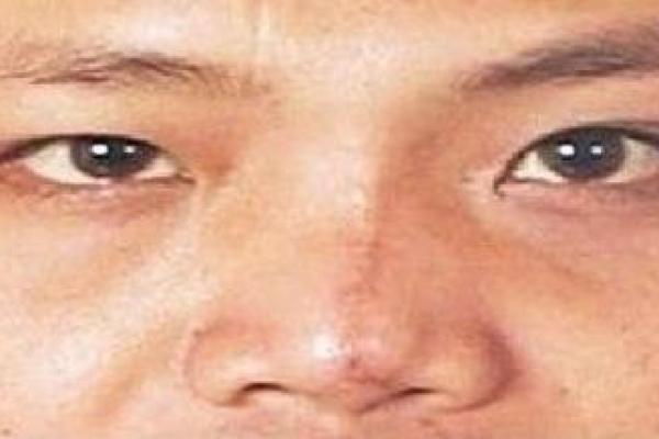 揭秘歪嘴命理：看似平常的面相背后隐藏的命运密码