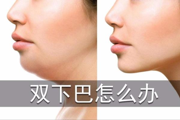 双下巴男人的命运与生活:揭示身体特征背后的故事 双下巴男人的命运与生活:揭示身体特征背后的故事