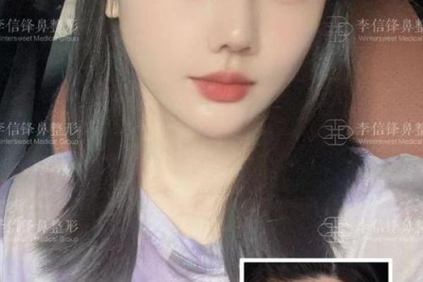探秘鼻孔大外漏，解读其命理与生活影响！