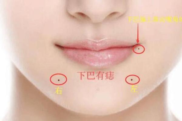 探索眼角痣的命运之谜：你是否也好奇它的寓意？