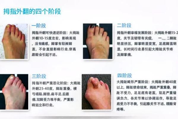 脚的图形与命运的奥秘：探寻身心的微妙联系
