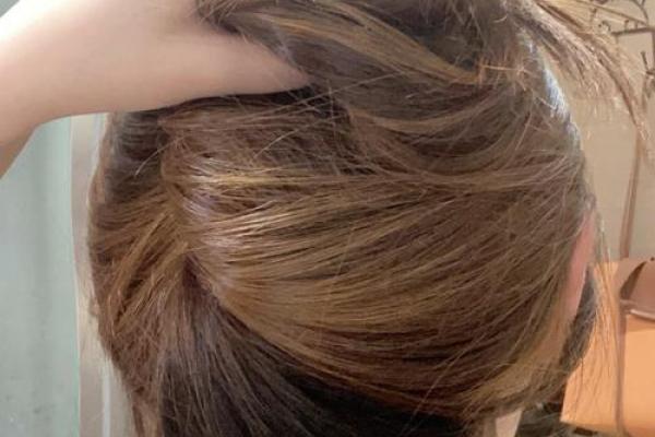 天生秃头的人命理解析:光头背后的深意与命运走向 天生秃头的人命理解析:光头背后的深意与命运走向