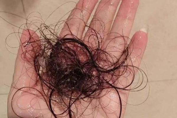 天生秃头的人命理解析:光头背后的深意与命运走向 天生秃头的人命理解析:光头背后的深意与命运走向