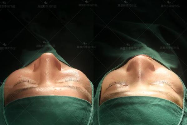 揭秘鼻翼窄鼻头小的命运：内在与外在的和谐之道