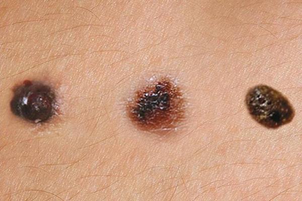 脚指细长的命运:探秘其独特的生命轨迹与性格特征 脚指细长的命运:探秘其独特的生命轨迹与性格特征