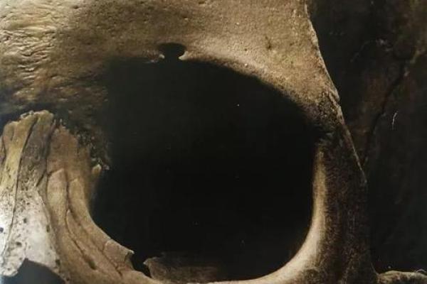 幼年大病不死,命运的微妙转折与人生的深刻启示 幼年大病不死,命运的微妙转折与人生的深刻启示