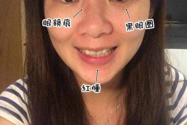 孩子的鼻梁塌陷,是命运的印记还是成长的选择? 孩子的鼻梁塌陷,是命运的印记还是成长的选择?