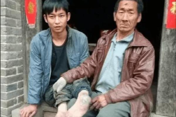 探秘先天残疾与命格:生命中的挑战与机遇 探秘先天残疾与命格:生命中的挑战与机遇