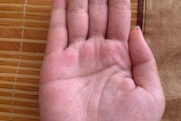 双手断掌女性命运解读:揭示隐藏在手掌中的智慧与潜能 双手断掌女性命运解读:揭示隐藏在手掌中的智慧与潜能