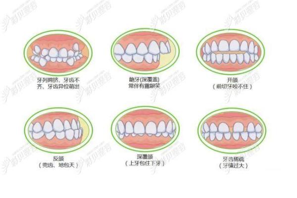探秘38颗牙齿的命运之谜：从口腔到人生的奥秘解读