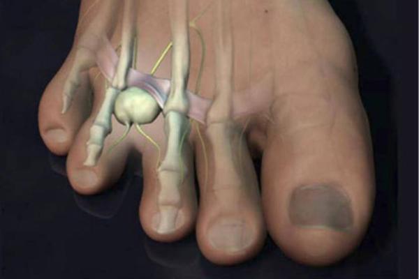 脚趾齐的命理解析：你的命运与足部形态密不可分！