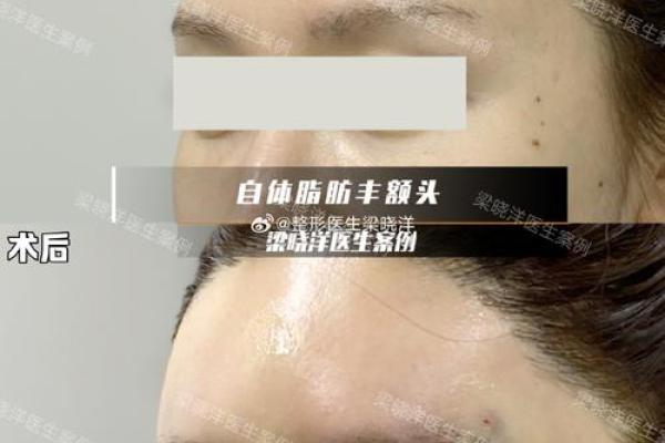 额头凸起的命运解析：你的额头透露了什么？