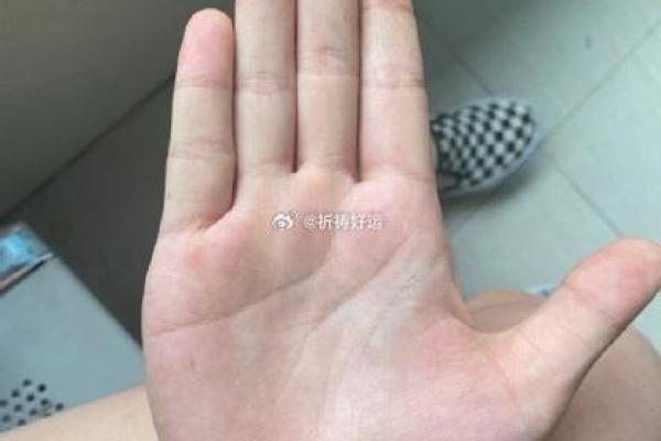 胸前胎记的命运密码：揭示隐藏的性格与人生轨迹