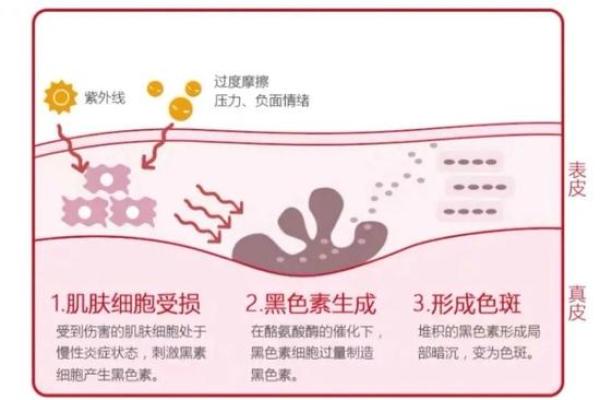 皮肤健康与命运:探索肤色与生命质量的关系 皮肤健康与命运:探索肤色与生命质量的关系