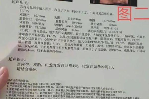 命理解析：为何人生会经历大起大落？