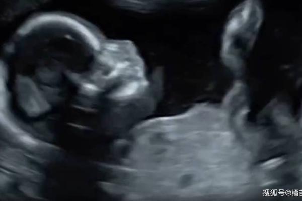 从心灵的创伤中绽放：自幼丧母者的人生轨迹与命运思考