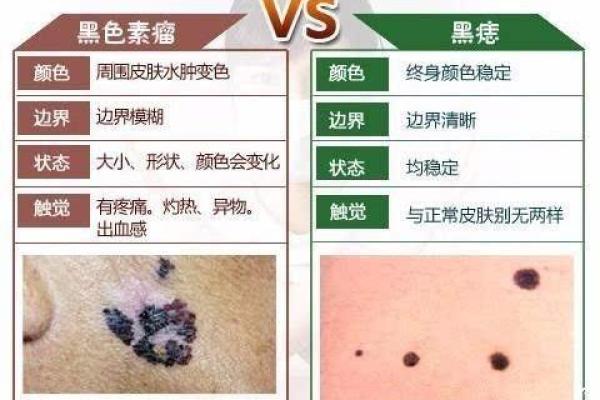 外阴黑痣之谜：命运与象征的深刻解读