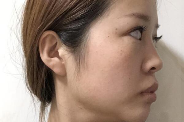 女人有胎记的命格：她们的运势与性格的秘密探秘